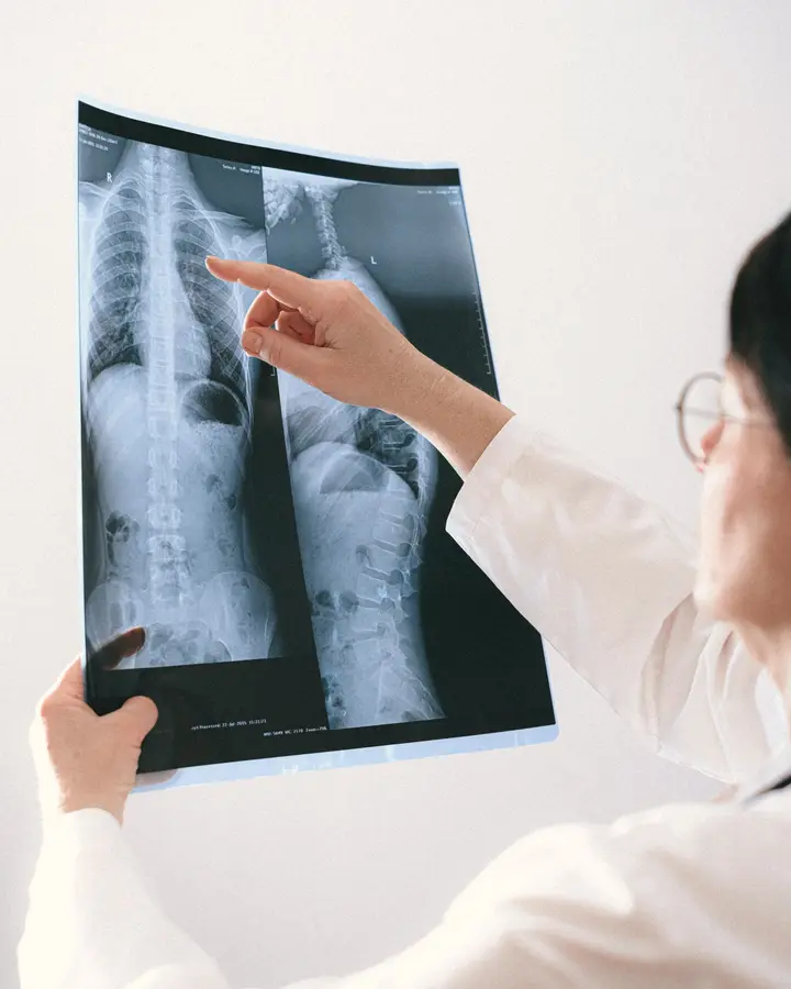 A doctor in a white coat points to a spine X-ray held up to the light.
